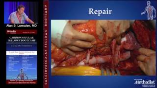 Download Lagu Open Surgical Management of Thoracic and Thoraco-Abdominal Aortic Aneurysm (Alan B. Lumsden, MD) Thumbnail