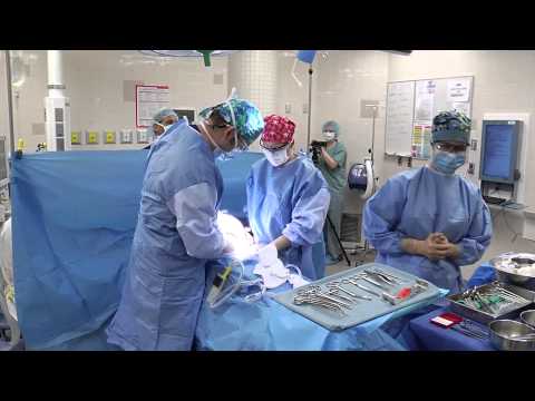 Pre-operative C-Section Patient Video