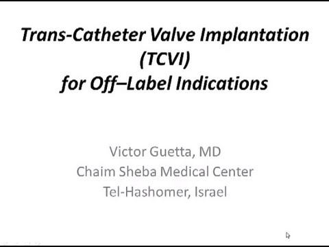 TAVI for non-Classical Indication (VIV, AR) | Prof. Victor Guetta