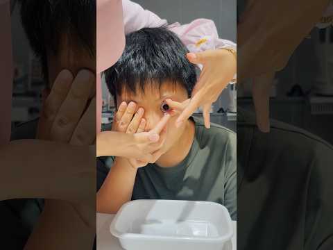 专业OK镜（角膜塑形镜）验配全流程展示