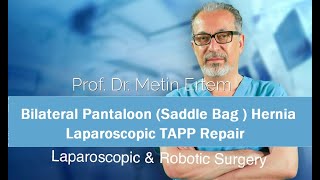 Miniaturka - Bilateral Pantaloon Hernia. TAPP Repair. Metin Ertem. MD.FACS.