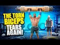 THE TORN BICEPS TEARS AGAIN!