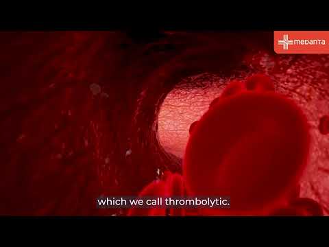 Heart Attack: What to Do in the Golden Hour | Dr. Parneesh Arora | Medanta
