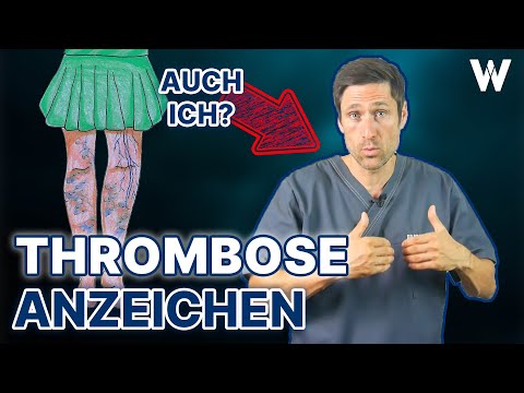 Thrombose: Plötzliche Anzeichen und Lebensgefahr! Typische Auslöser von Sitzen über Pille bis Corona