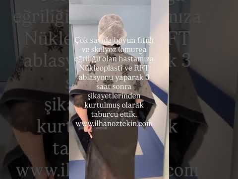 Boyun fıtığı ve skolyoz için Nükleoplasti ve RFT Ablasyonu