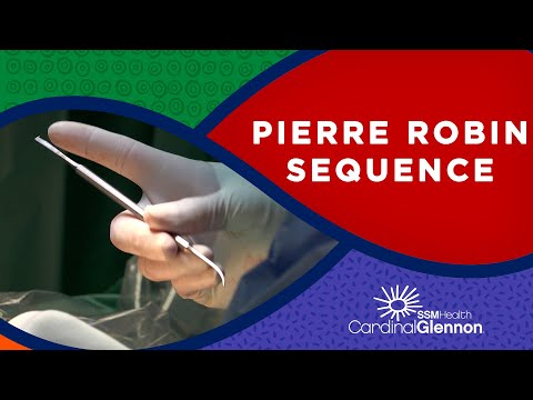 Pierre Robin Sequence Treatments & What it Is - Pediatric Plastic Surgery