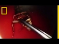 A Cockroach Crawled Inside A Woman S Head See How A Doctor Got It Out National Geographic