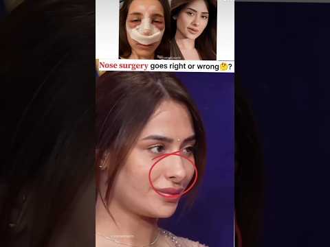 mahira sharma surgery face🫡...#mahirasharma #salmankhan
