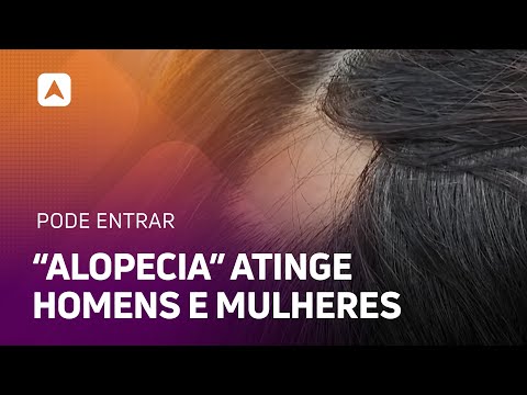 Biomédica explica sobre o diagnóstico e o tratamento da Alopecia, que atinge homens e mulheres