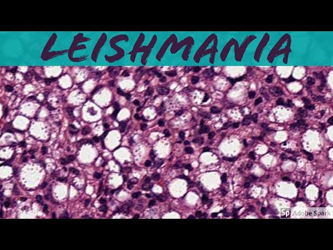, title : 'Leishmaniasis: 5-Minute Pathology Pearls'