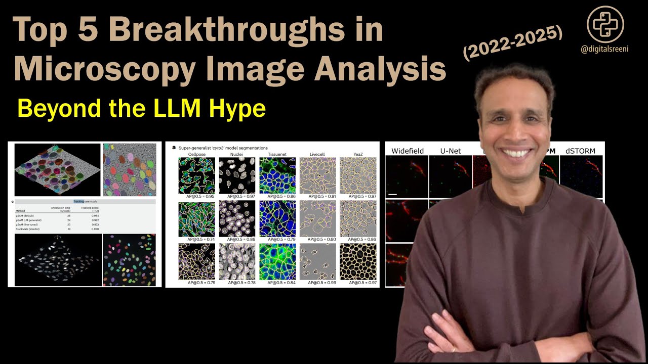 Top 5 Breakthroughs in Microscopy Image Analysis (377 )