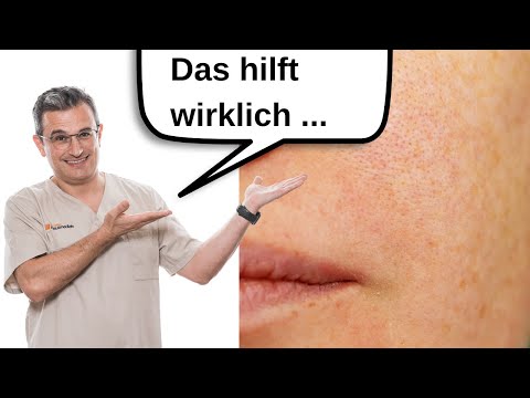 Refining pores: Dermatologist explains | Dr. Kasten Dermatology in Mainz