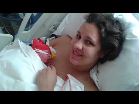 emergency C-section for 32 week twins-My story #twinbirth #preemietwins #nosmallcreator