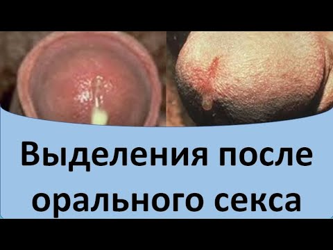 Выделения после орального секса