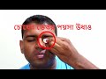 Coin Vanish Inside The Eye Coin Magic Trick