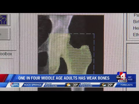 One in every 4 middle age adults has weak bones