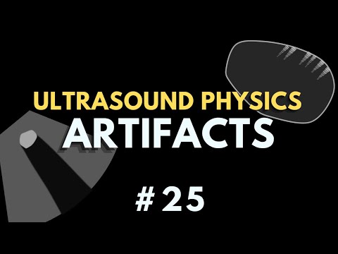 Ultrasound Artifacts | Ultrasound Physics Course | Radiology Physics Course #25