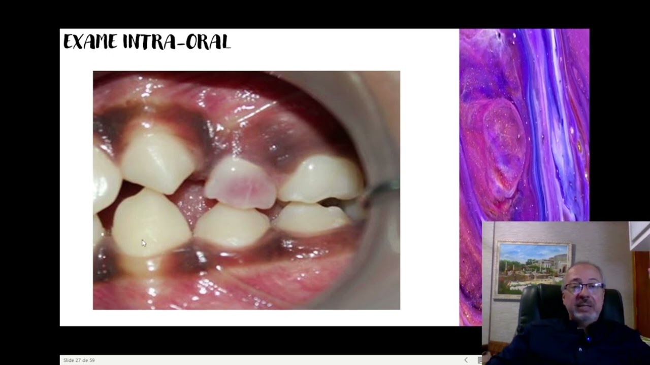 Recursos Semiotécnicos