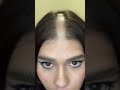 Razor Headshave Right In The Middle Of Head