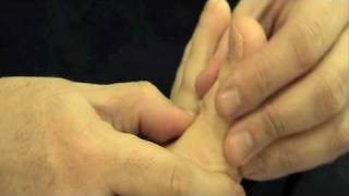 Sesamoiditis y tendinitis del primer metatarsiano 1