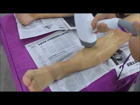 Big spot size Diode laser hair removal machine US408