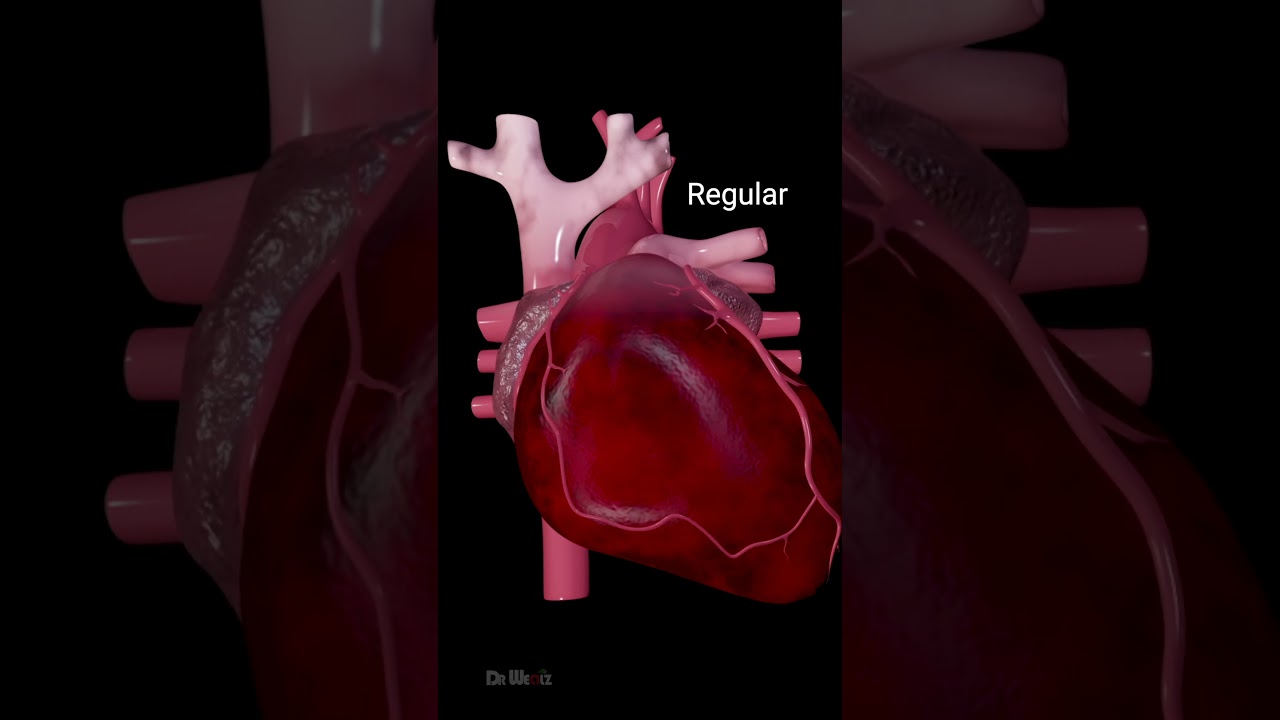 Heart Arrhythmias: Different Types and Symptoms