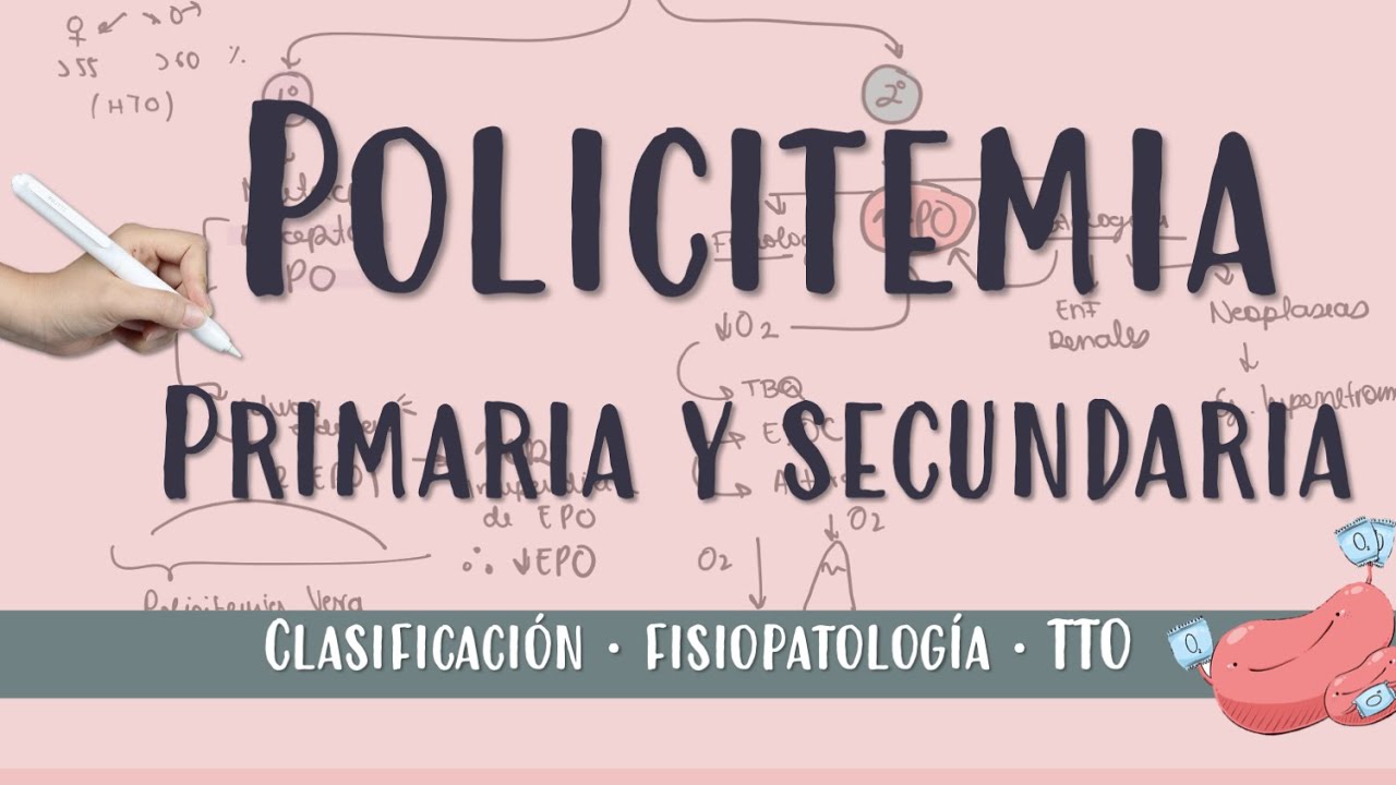 #POLICITEMIAVERA #policitemiasecundaria #policitemia #eritropoyetina #jak2