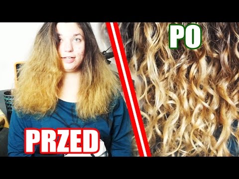 Maska że nie wspinać włosy Zaburzenia endokrynologiczne wypadanie włosów