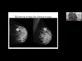 Safe And Optimum Approach To Breast Diseases