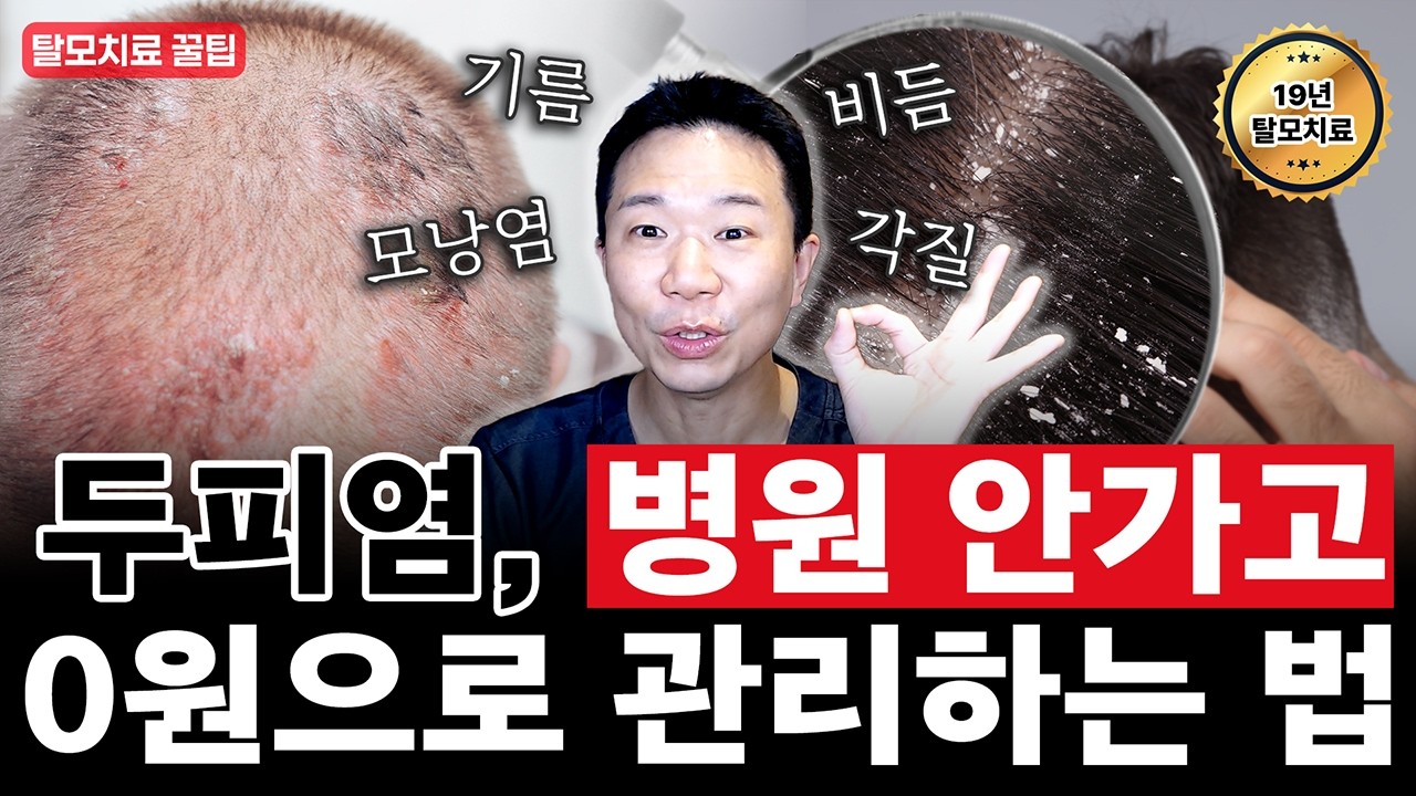  두피염, 아직도 돈쓰고 계신가요? 핵심은 생활습관입니다! ( 증상, 치료, 관리방법, 탈모 )