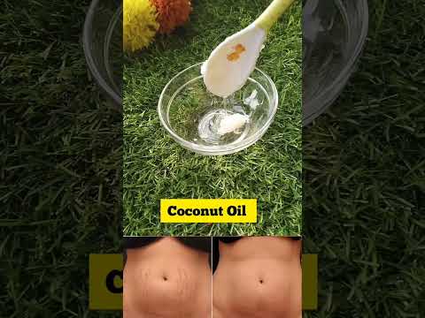 ✨Stretch Marks Removal At Home/How To Remove Stretch Marks#shorts#stretchmarks #stretch #viral#hack
