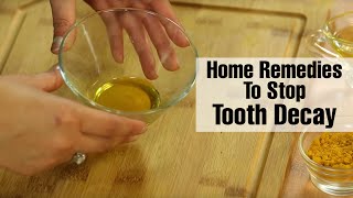 Natural TOOTH DECAY TREATMENTS | How To Remove Tooth Decay At Home