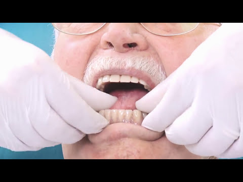 Zahnprothesen richtig herausnehmen und einsetzen | Tipps für pflegende Angehörige