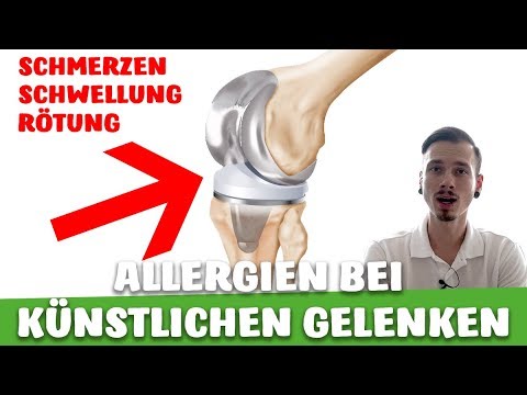 34 Wochen der Schwangerschaft Rückenschmerzen Knie auf das Kniegelenk zu arbeiten