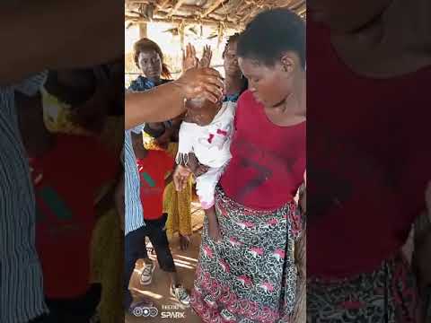 Missionario Africa Doenca de Ferida na Cabeca de Crianca