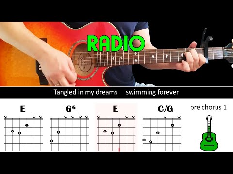 Radio - The Corrs