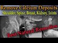 Remove Painful Calcium Deposits From Your Body (3 Best Home Remedies) - Dr Mandell