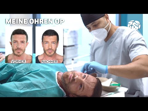 Ohren Anlegen - Mein Erfahrungsbericht