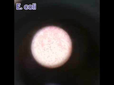 Escherichia coli gram stain Microbiology Bacteriology Ecoli