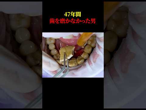 フランスの市販薬用植物リスト - 定義