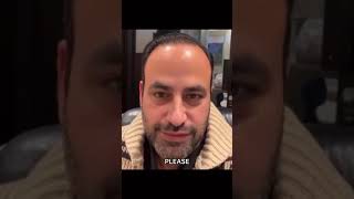 UNDER EYE FILLER WARNING!!!!!!