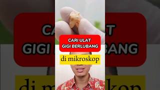 Download lagu THIS IS A CAVITY LOOKING AT A MICROSCOPE mp3 Download lagu THIS IS A CAVITY LOOKING AT A MICROSCOPE mp3