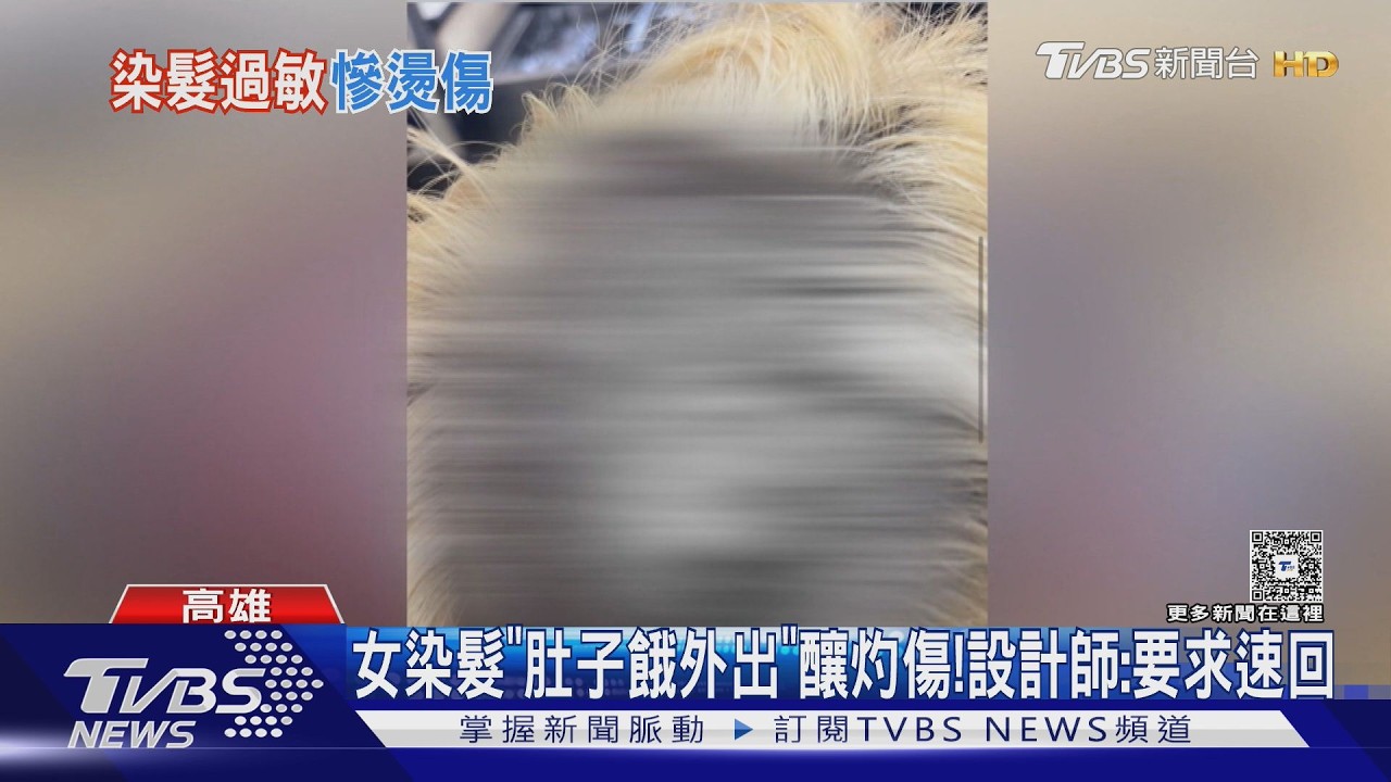 影音/女染髮肚子餓「外出吃飯」釀灼傷! 設計師冤:要求速回