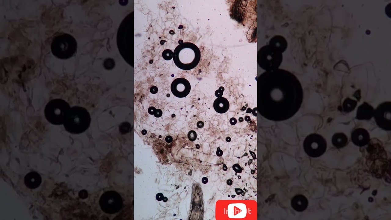 Banana Rotten Vs Fresh On Microscope Watch Video