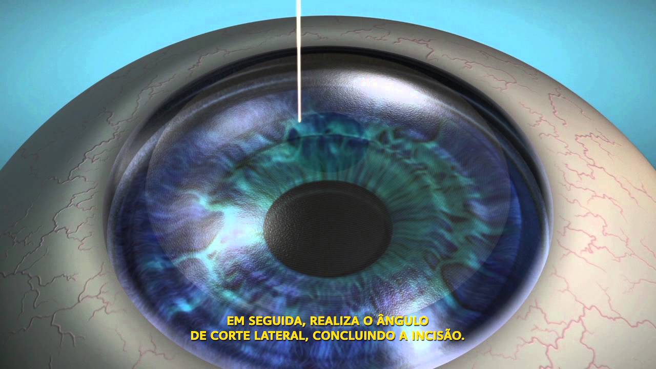 Guy Romaguera Canto-14