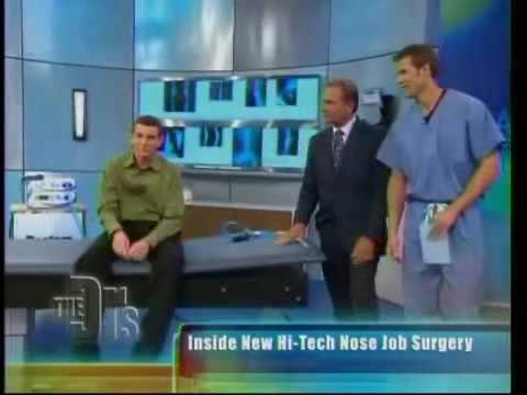 Watch Video: CBS The Doctors - Precision Rhinoplasty