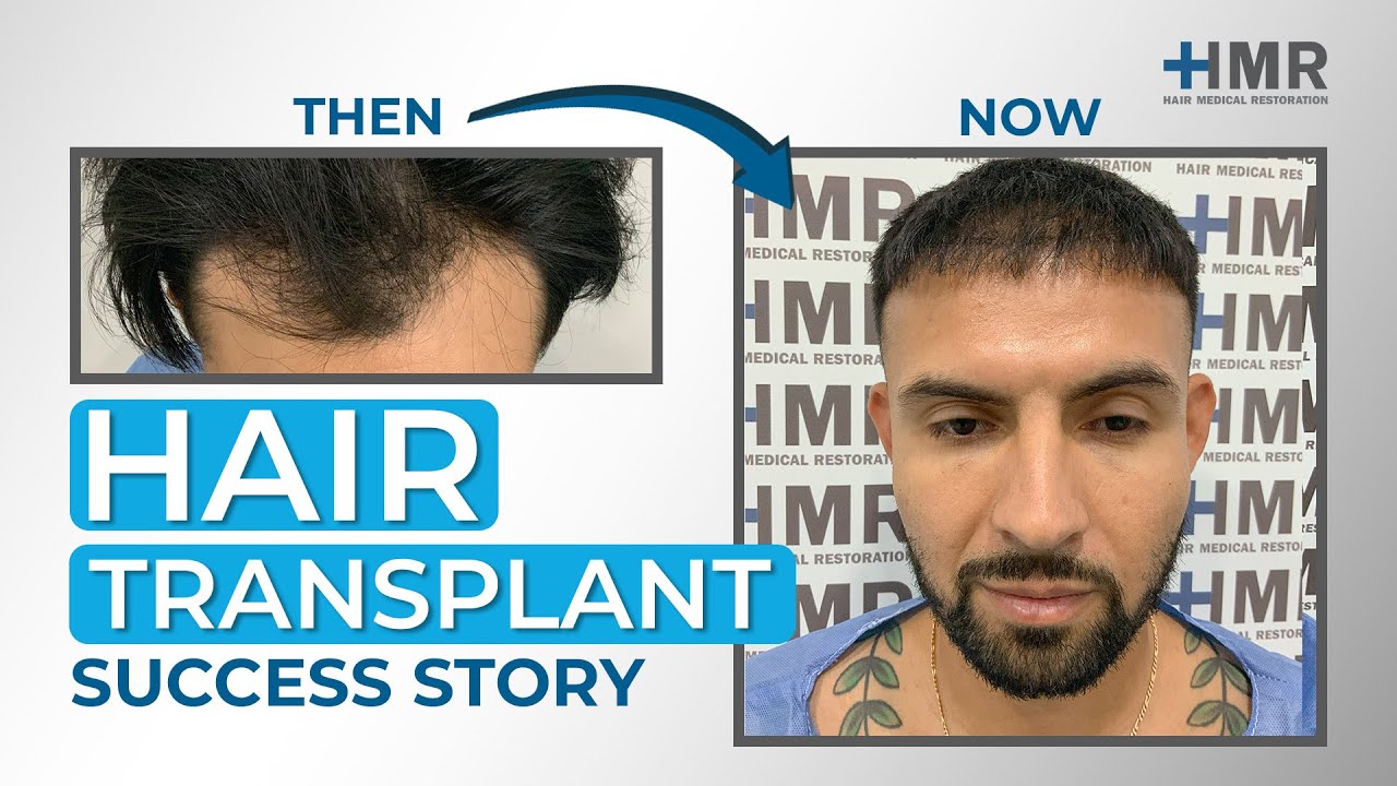 Jorge Luis Guerrero Gallegos-10