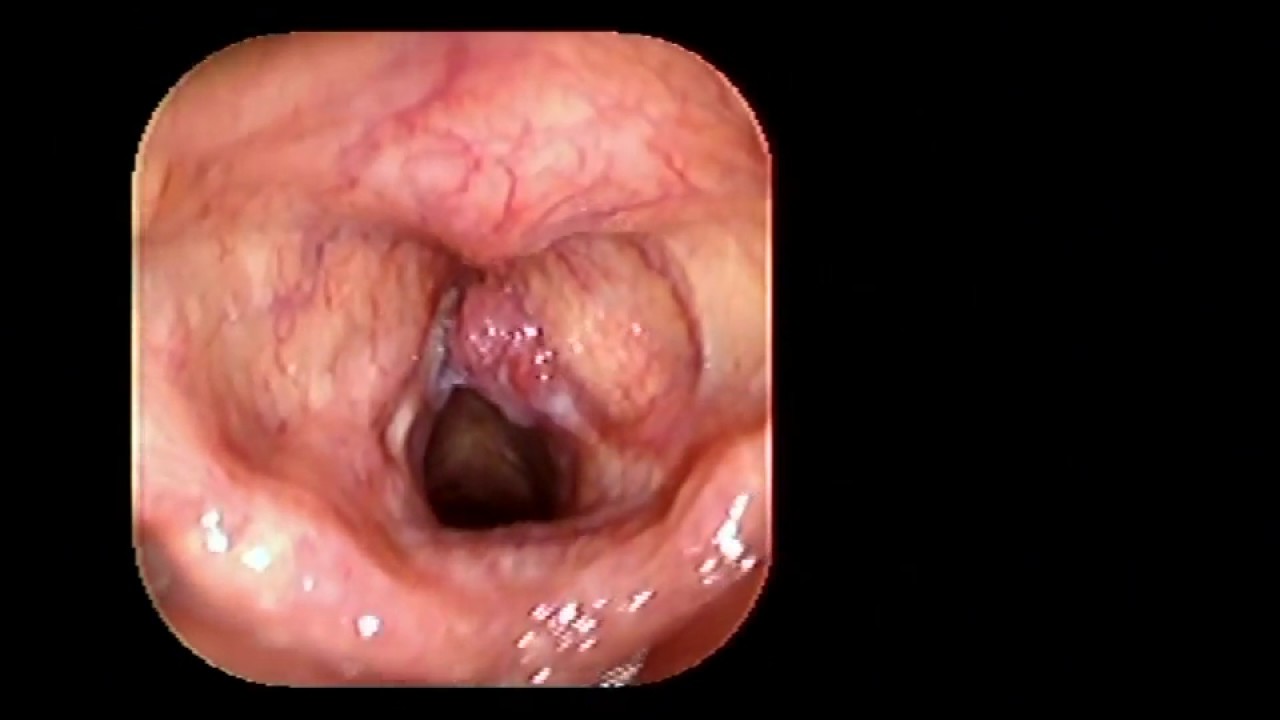 Joaquín Archibaldo Hope Guerrero-10