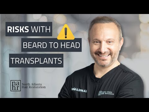 What They Don’t Tell You About Beard to Head Transplants