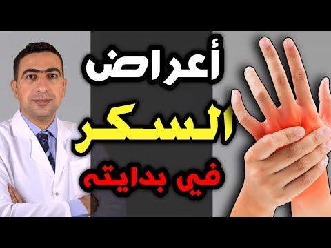 أعراض مرض السكر في بدايته ؟